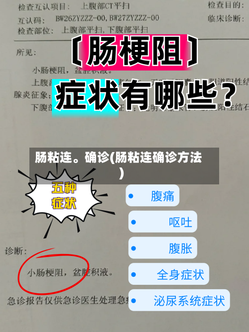肠粘连	。确诊(肠粘连确诊方法)-第3张图片