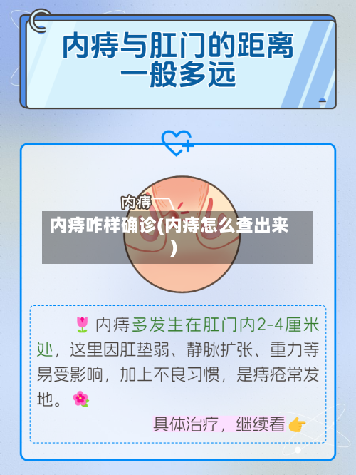 内痔咋样确诊(内痔怎么查出来)