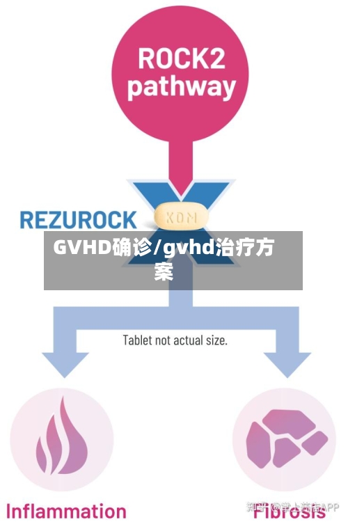 GVHD确诊/gvhd治疗方案-第2张图片