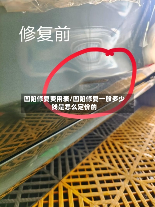 凹陷修复费用表/凹陷修复一般多少钱是怎么定价的-第3张图片