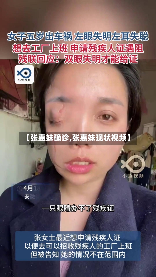 【张惠妹确诊,张惠妹现状视频】-第3张图片