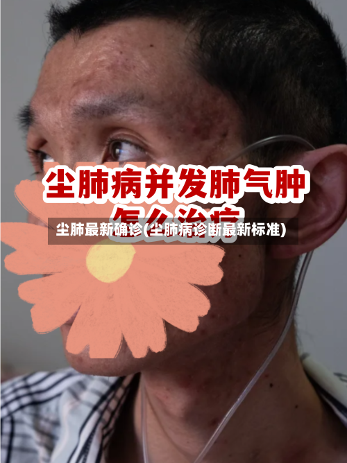 尘肺最新确诊(尘肺病诊断最新标准)-第2张图片