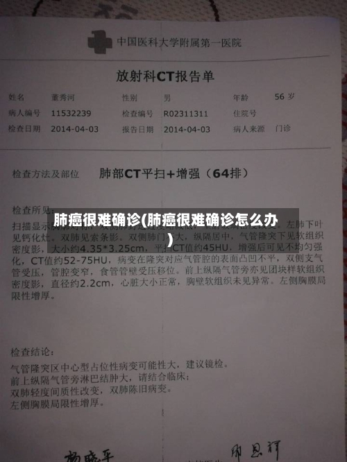 肺癌很难确诊(肺癌很难确诊怎么办)-第2张图片