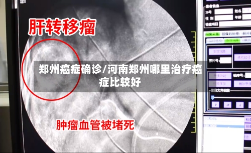 郑州癌症确诊/河南郑州哪里治疗癌症比较好