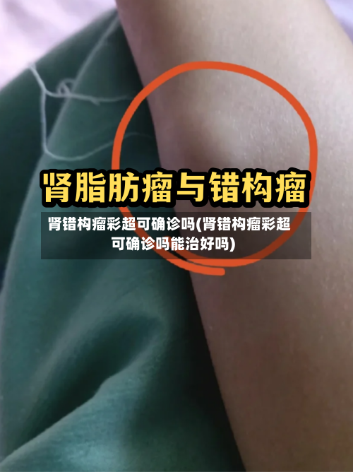 肾错构瘤彩超可确诊吗(肾错构瘤彩超可确诊吗能治好吗)