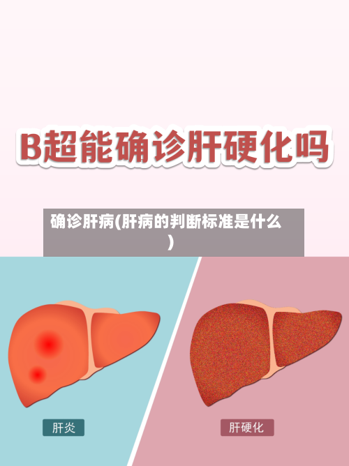 确诊肝病(肝病的判断标准是什么)-第2张图片