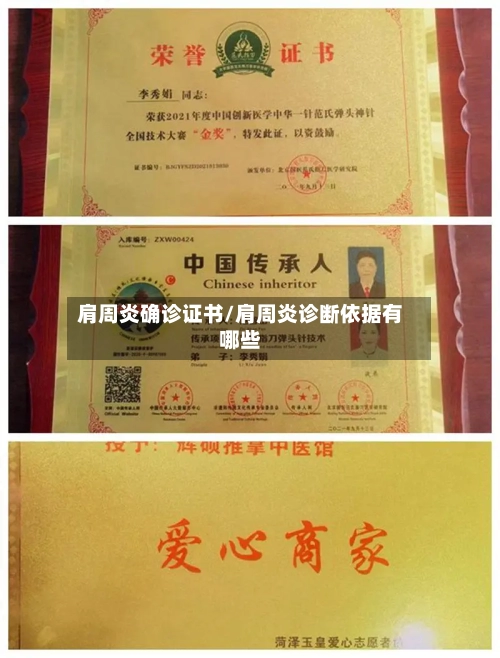 肩周炎确诊证书/肩周炎诊断依据有哪些-第2张图片