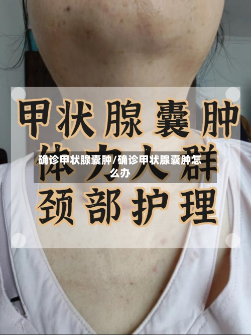 确诊甲状腺囊肿/确诊甲状腺囊肿怎么办