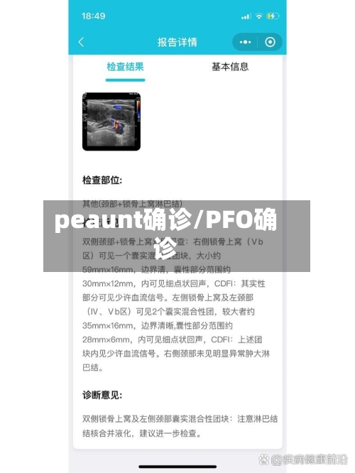 peaunt确诊/PFO确诊