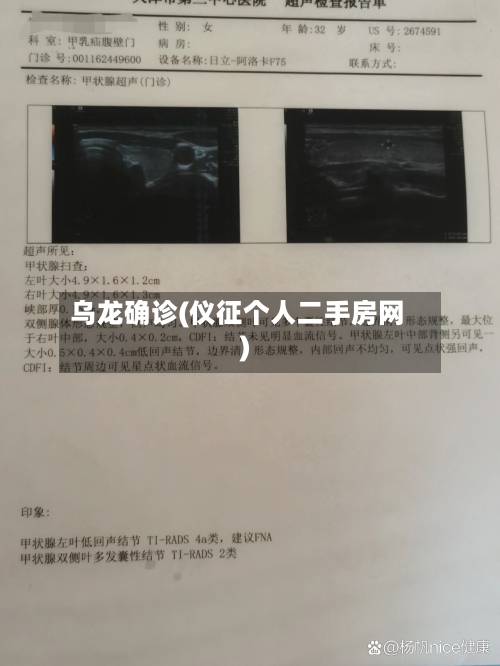 乌龙确诊(仪征个人二手房网)-第3张图片