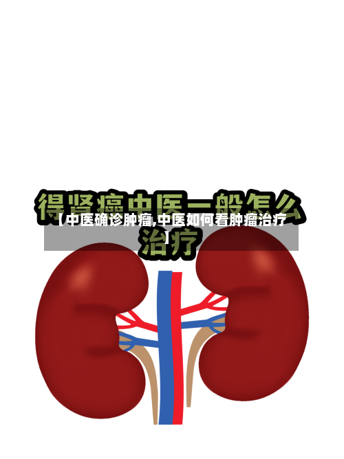 【中医确诊肿瘤,中医如何看肿瘤治疗】-第2张图片
