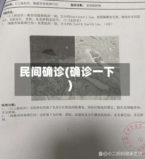 民间确诊(确诊一下)-第3张图片