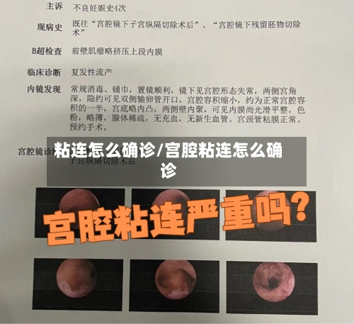 粘连怎么确诊/宫腔粘连怎么确诊-第2张图片