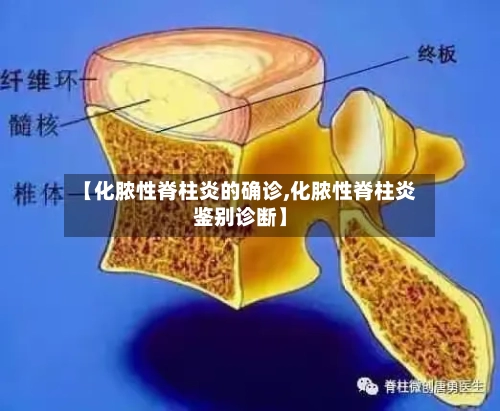 【化脓性脊柱炎的确诊,化脓性脊柱炎鉴别诊断】