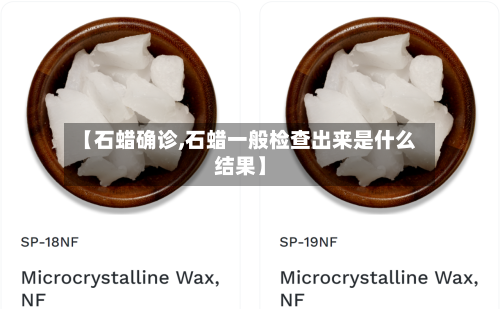 【石蜡确诊,石蜡一般检查出来是什么结果】