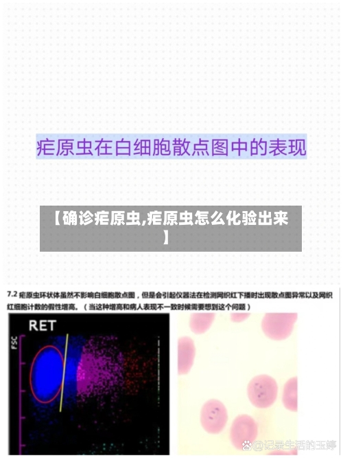 【确诊疟原虫,疟原虫怎么化验出来】