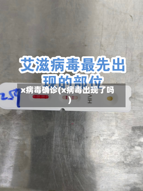 x病毒确诊(x病毒出现了吗)