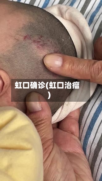 虹口确诊(虹口治瘤)-第2张图片