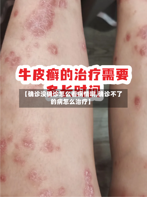 【确诊没确诊怎么看病情啊,确诊不了的病怎么治疗】