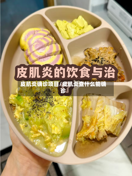 皮肌炎确诊项目/皮肌炎查什么能确诊