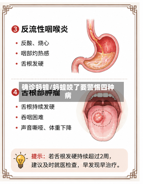 确诊蚂蝗/蚂蝗咬了要警惕四种病