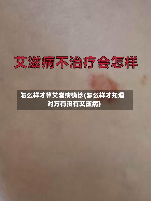 怎么样才算艾滋病确诊(怎么样才知道对方有没有艾滋病)-第3张图片
