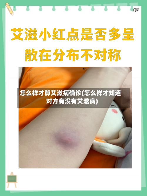 怎么样才算艾滋病确诊(怎么样才知道对方有没有艾滋病)-第2张图片