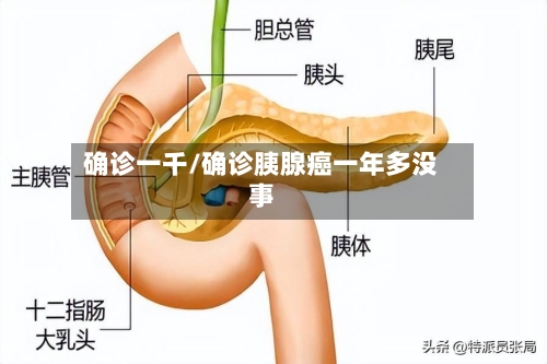 确诊一千/确诊胰腺癌一年多没事-第2张图片