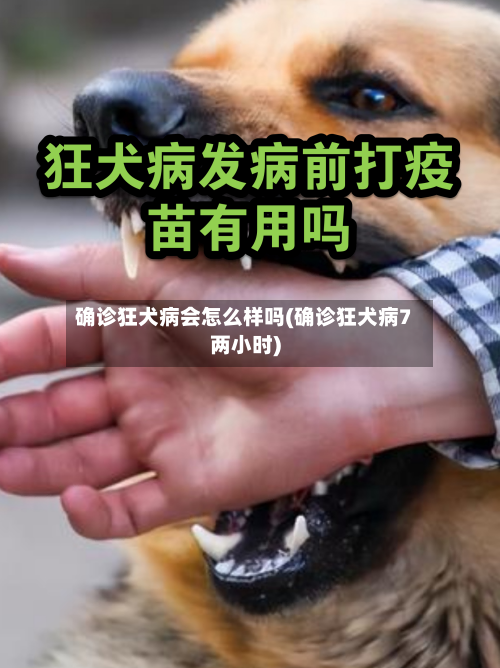 确诊狂犬病会怎么样吗(确诊狂犬病7两小时)-第2张图片