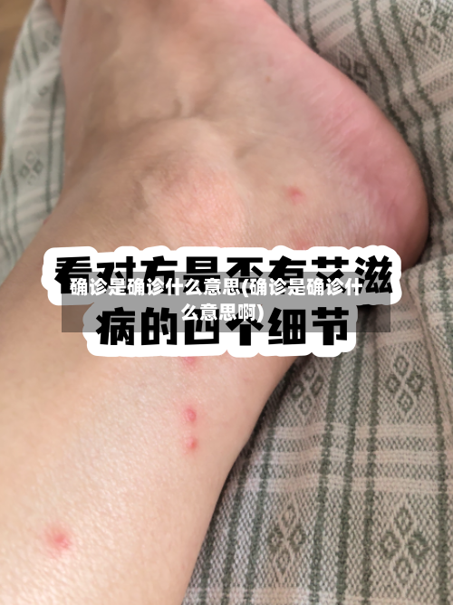 确诊是确诊什么意思(确诊是确诊什么意思啊)-第3张图片