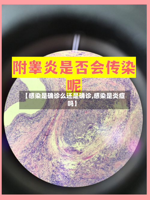 【感染是确诊么还是确诊,感染是炎症吗】