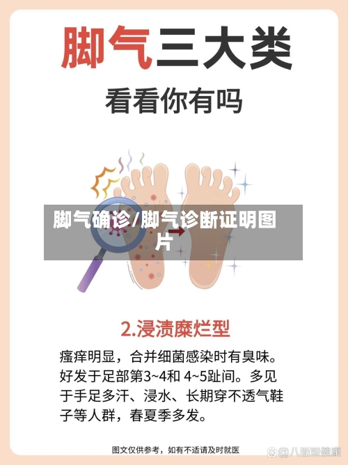 脚气确诊/脚气诊断证明图片