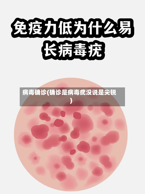 病毒确诊(确诊是病毒疣没说是尖锐)