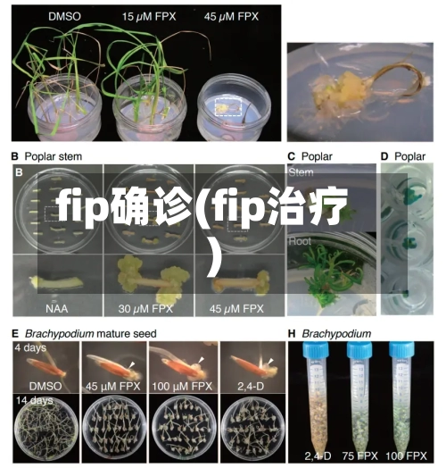 fip确诊(fip治疗)