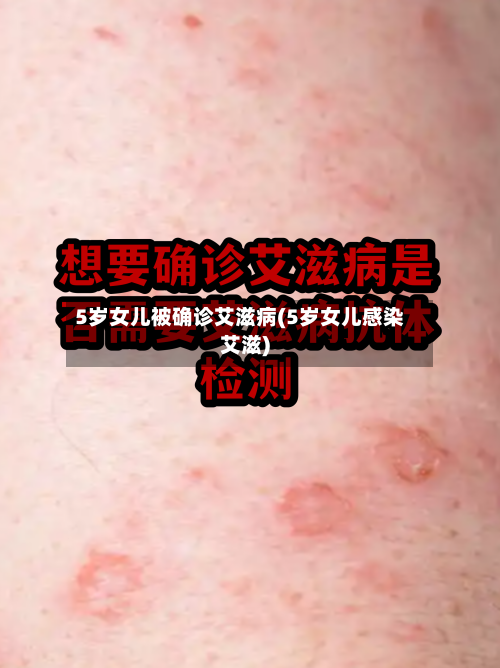 5岁女儿被确诊艾滋病(5岁女儿感染艾滋)