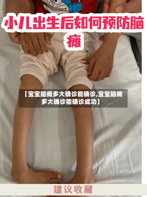 【宝宝脑瘫多大确诊能确诊,宝宝脑瘫多大确诊能确诊成功】-第3张图片
