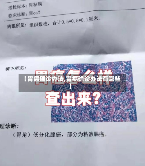 【胃癌确诊办法,胃癌确诊办法有哪些】-第3张图片