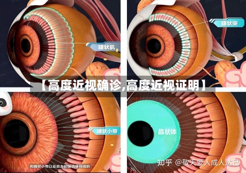 【高度近视确诊,高度近视证明】-第2张图片