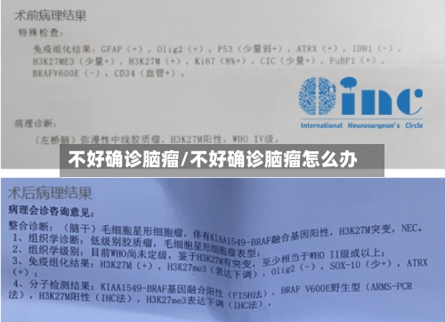 不好确诊脑瘤/不好确诊脑瘤怎么办-第3张图片