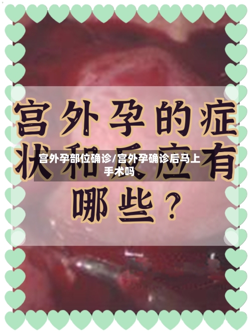 宫外孕部位确诊/宫外孕确诊后马上手术吗