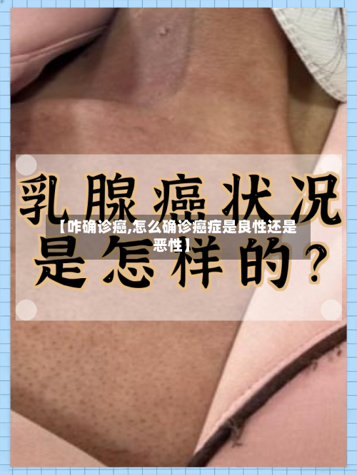 【咋确诊癌,怎么确诊癌症是良性还是恶性】-第3张图片