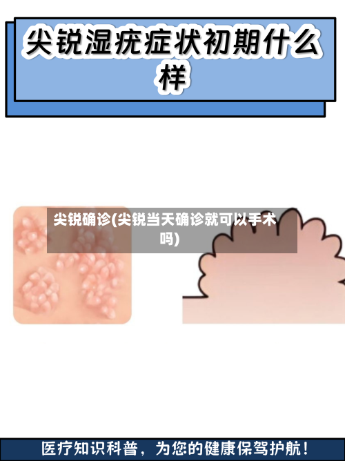 尖锐确诊(尖锐当天确诊就可以手术吗)