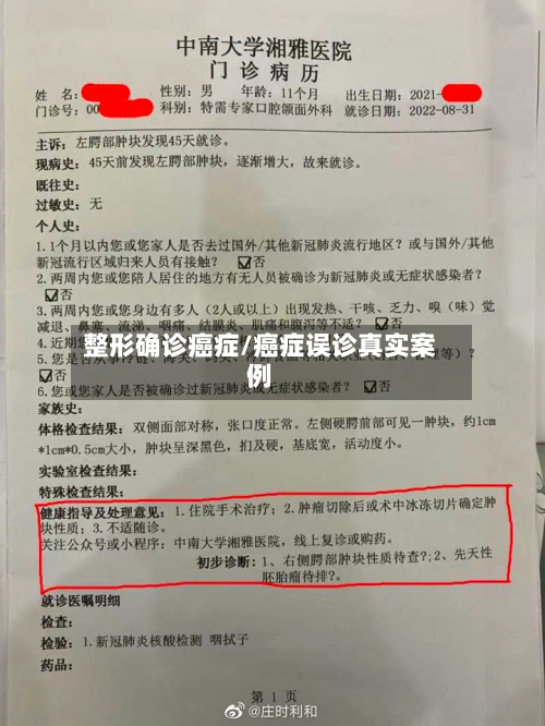 整形确诊癌症/癌症误诊真实案例