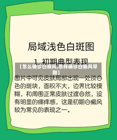 【怎么确诊白癫风,怎样确诊白癜风早期】-第1张图片
