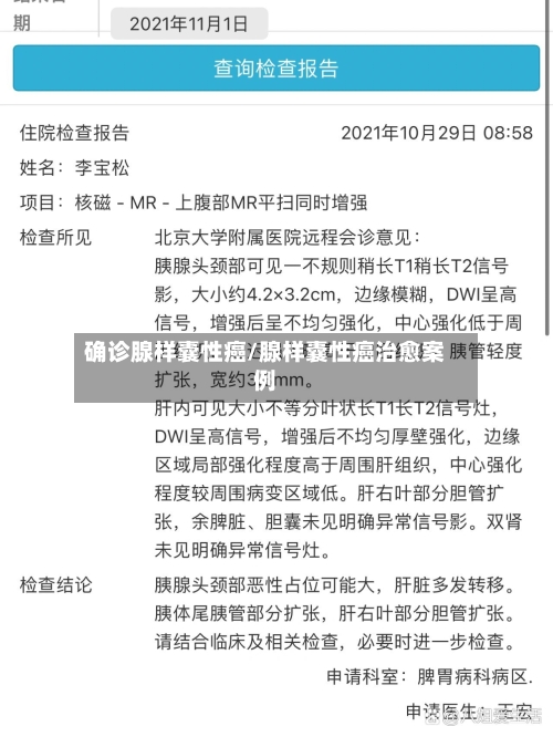 确诊腺样囊性癌/腺样囊性癌治愈案例