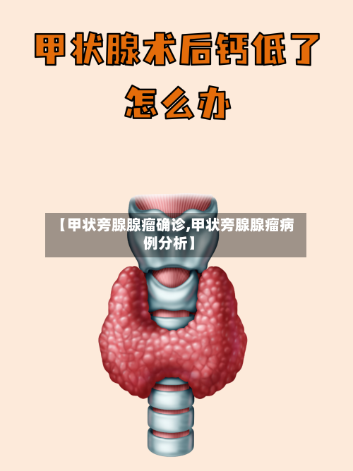 【甲状旁腺腺瘤确诊,甲状旁腺腺瘤病例分析】-第2张图片